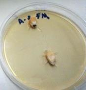 pertencer à espécie Aspergillus flavus ou Aspergillus parasiticus, visto que a região IGS é altamente variável e pode ser usada para diferenciar fungos em nível de espécie incluindo ambas em um mesmo