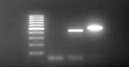 Primer F Nes_F Nes_F PCR_F PCR_F Nes_F Nes_F Primer R PCR_R PCR_R Nes_R Nes_R Nes_R Nes_R diluição 1 1/100 1 1/100 1 1/100 neg 1000bp 900bp 800bp 700bp 600bp 500bp 400bp 300bp 200bp 100bp Figura 7.