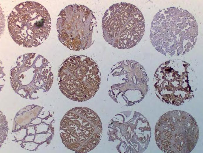 GSTP-1 objetiva de 5x.