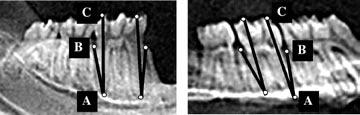 Figura 2 Análise do SOP realizado em radiografia digital da mandíbula (esquerda) e maxila (direita).