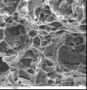 83b e 4.84b). A presença de diferentes micromecanimos de fratura nesse material é esperada uma vez que coexistem na microestrutura fases com diferentes características de resistência e ductilidade.