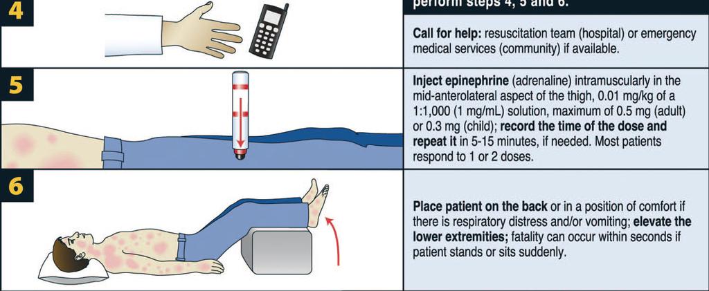 Anaphylaxis Simons FER, Ardusso LRF, Biló MB et al.