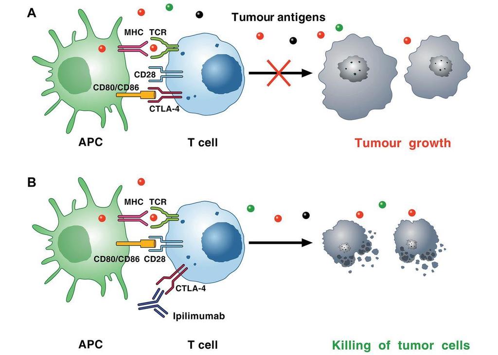 Ipilimumab Utilizados em estágios avançados de