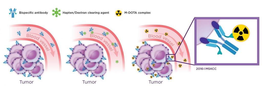 Cancer colorretal Linfomas Mieloma