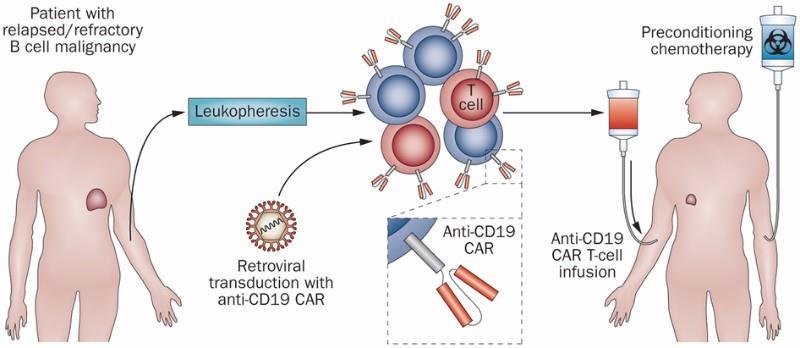 Terapia celular no tratamento contra o câncer Terapia CAR-T Chimeric Antigen Receptor (Combinação de terapia celular, terapia gênica e imunoterapia) A terapia CAR-T têm demonstrado altas taxas de