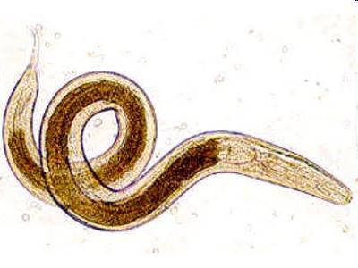 Enterobius vermicularis Verme microscópico (10 a 12 mm) que parasitam o intestino grosso, causando a oxiurose.