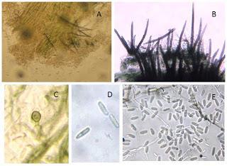 ANTRACNOSE/ MANCHA CHOCOLATE (Colletotrichum