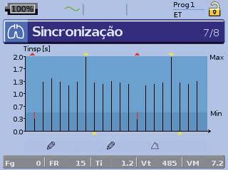 A altura da barra indica o tempo de inspiração. Nos modos E/ET, os limiares de Ti Mín/Ti Máx são exibidos como Mín/Máx. Definições alteradas. Alarme ativado.