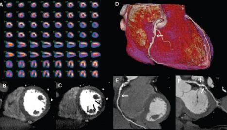 Volume CT - 256 cortes