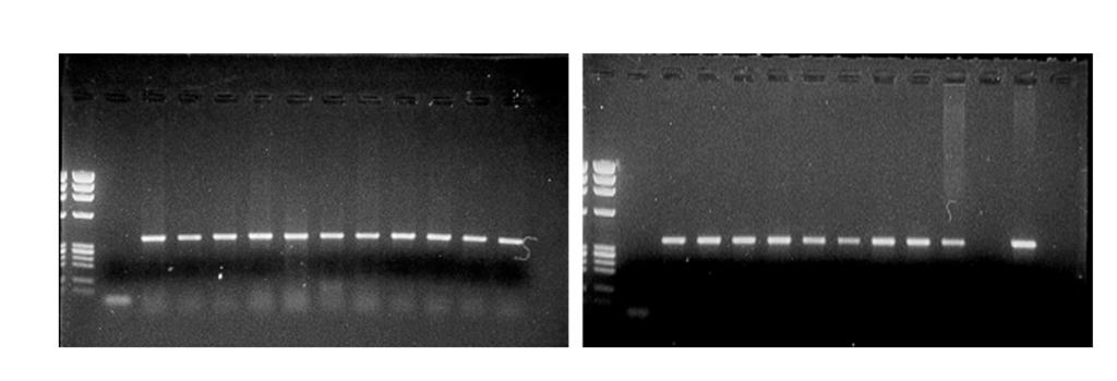 Figura 1. Amostras de DNA dos controles extraídas de swab oral utilizando NaCl (colunas 1 11) ou kit comercial (12 17) em gel de agarose 1%.
