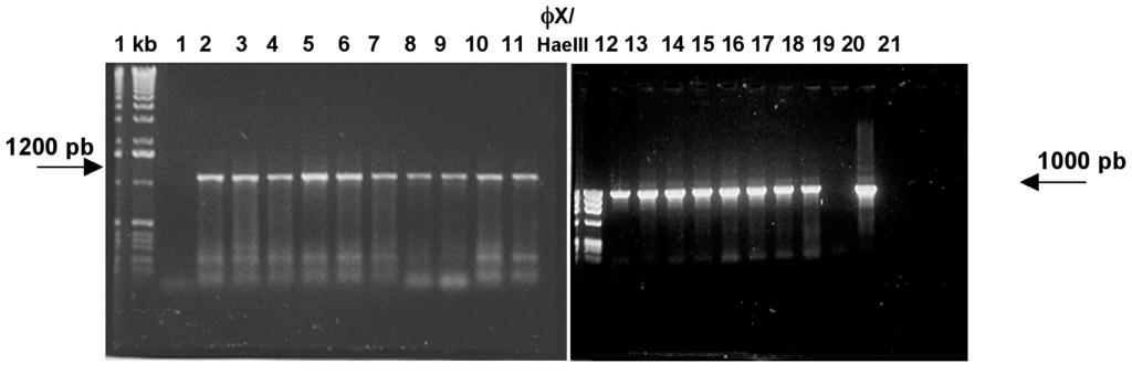 Amplificação do éxon 2 do PROP1 em amostras de DNA de controles extraídas de swab oral com NaCl (colunas 2 12), ou kit comercial (colunas 14 22) e de sangue periférico (coluna 24).