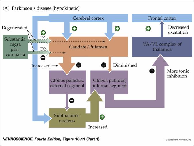 Mal de Parkinson Doença Hipocinética Diminuição do efeito de excitabilidade na alça direta e