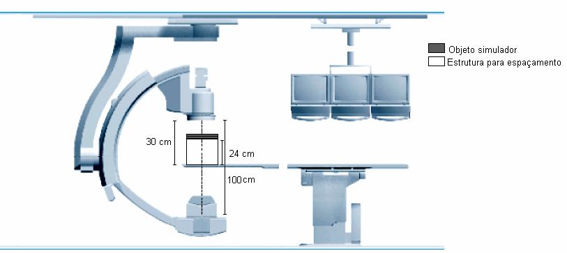 138 Anexo B Protocolo de aquisição das imagens. 1) Posição antero-posterior com tubo de raios X embaixo da mesa. 2) Distância Ponto Focal - TII de 100 cm. 3) Posicionar o objeto simulador (item 4.2.5) de forma que a mesa fique a 30 cm da entrada do TII utilizando um espaçador.