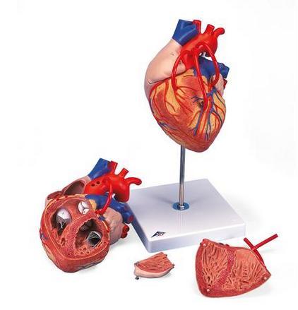 Coração com pontagem coronária 3B Scientific https://www.3bscientific.com.br/coracao-com-pontagem-coronaria-2-vezes-o-tamanhonatural-4-partes-g06,p_33_282.