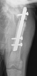 5 anestesia epidural com bupivacaína (1 ml/4 kg). A antissepsia foi feita de maneira padrão, e o acesso à diáfise femoral segundo a técnica descrita por Piermattei & Flo (1999).