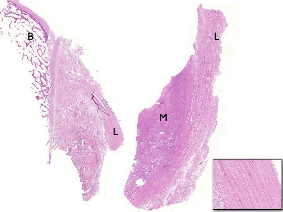 58 Figura 13 Análise histológica do ligamento anterolateral do joelho mostrando com detalhes a origem femoral do ligamento (L) saindo do epicôndilo lateral (B) e sua inserção na periferia do menisco