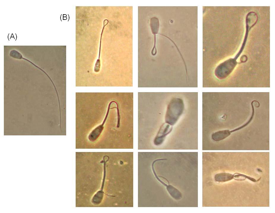 Figura 1. Espermatozóide não reativo (A) e os principais tipos de dobramentos de cauda encontrados na realização do teste hiposmótico (B) (Fonte: arquivo pessoal do autor). 2.