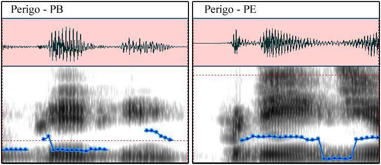 23 PERIGO CV.CV.CV No vocábulo perigo a vogal átona pretônica foi omitida no PE e, no PB, teve duração de 0.072s. A vogal tônica durou 0.083s no PE e 0.11s no PB.
