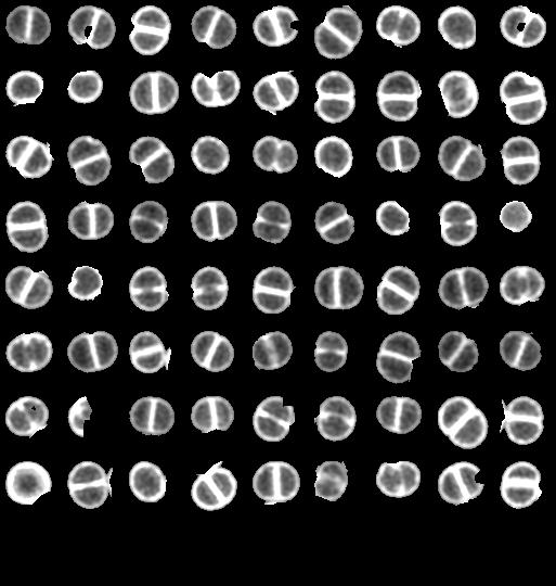 Aplicações Microscopia de fluorescência de