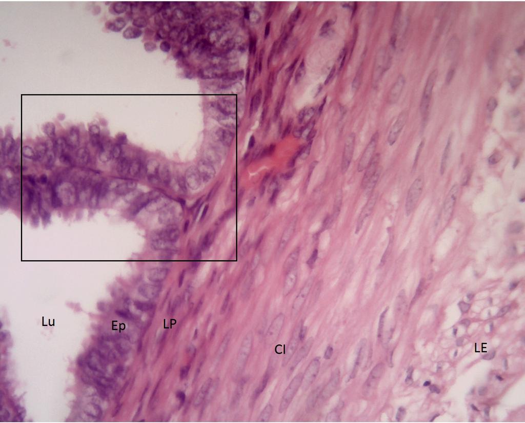 81 LÂMINA: TUBA UTERINA HE) (Objetiva 40: Aumento 400X) Fotomicrografia 03: Nessa fotomicrografia de maior aumento observe a túnica mucosa que reveste o lúmen (Lu) da tuba uterina formada por