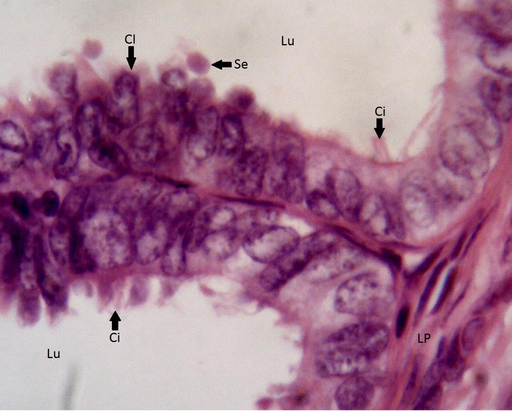 82 LÂMINA: TUBA UTERINA HE) (Objetiva 100: Aumento 1000X) Fotomicrografia 04: Nessa fotomicrografia de grande aumento observe a mucosa da tuba uterina que reveste o lúmen (Lu) formada por epitélio