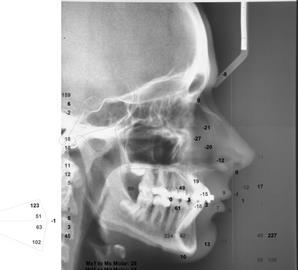 Resultados da cefalometria.).