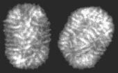 Medidas comuns em virologia Micron ( ) = 1/1 000 mm (10-3 mm) Nanômetro (nm) = 1/1 000 000 mm (10-6 mm) Ângstrom (Å) = 1/ 10