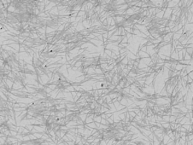 (2005) Fusobacterium nucleatum Fusobacterium nucleatum Ágarsangue ÁgarOmata Disraely Coloraçãode Gram Fímbrias Cápsula β-lactamase