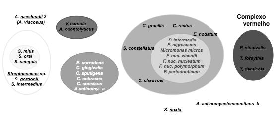 Cálculo complexa Destruição periodonto