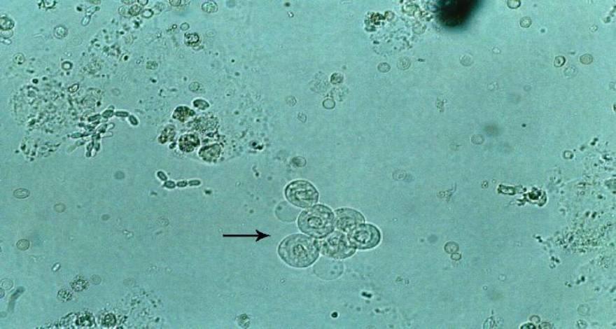 Introdução ESPOROS DE LEVEDURAS HEMÁCIAS CÉLULAS TUBULARES DO EPITÉLIO RENAL EXEMPLO DE LIMITE DE RESOLUÇÃO: É A MENOR DISTÂNCIA QUE DEVE EXISTIR ENTRE DOIS PONTOS PARA QUE ELES