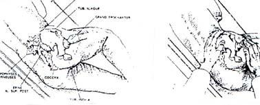 88 Palpação da tuberosidade isquiática e Palpação da bolsa trocanteriana Anatomia Palpatória Triângulo de Scarpa e Palpação da Artéria Femoral Uma dor e edema no triângulo de Scarpa podem