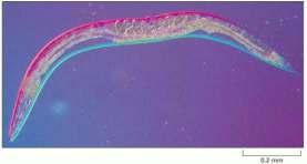 LISOSSOMO As primeiras evidências de que certos genes controlam o desaparecimento das células vieram de estudos com C. elegans.