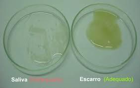 ESCARRO Não é considerado ideal para avaliação microbiológica do trato respiratório hemocultura, lavado