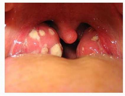 na mucosa bucal a contaminação com saliva, que contém uma flora
