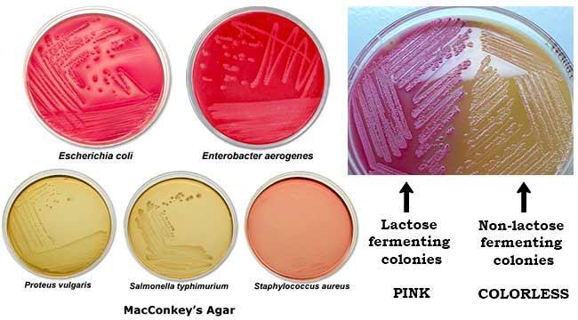 Agar