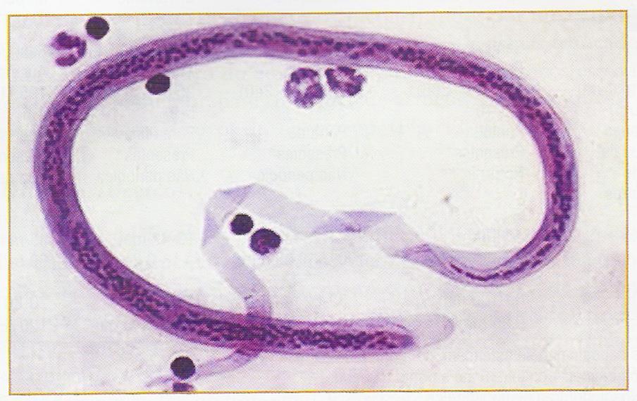 Microfilária Presença de bainha Cauda pontuda com núcleos