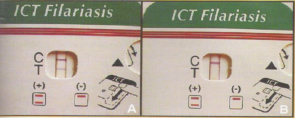 Diagnóstico sorológico Teste imunocromatográfico desenvolvido pelo ICT Diagnostic - ICT card