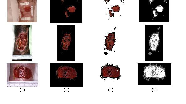 Resultados do Treinamento 1...50 Teste da Rede Neural MLP Contagem de pixels de cada imagem 1...50 Técnicas de Processamento de Imagens Cálculo da porcentagem de cada tecido 1.