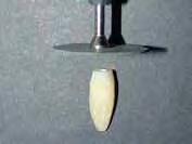 1 Preparo dos espécimes Foram utilizados 60 dentes humanos unirradiculados, recém-extraídos por indicações clínicas diversas e com prévia