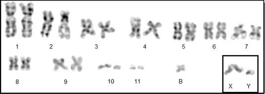 Figura 5. Figura 5: Metáfase em bandeamento GTG, em destaque o cromossomo B e o par sexual.