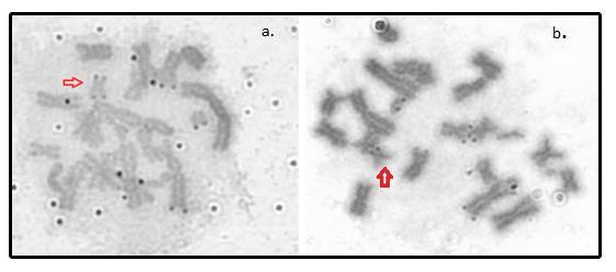Figura 7: Metáfases em Ag-NOR, mostrando marcações em autossomos e cromossomos B.