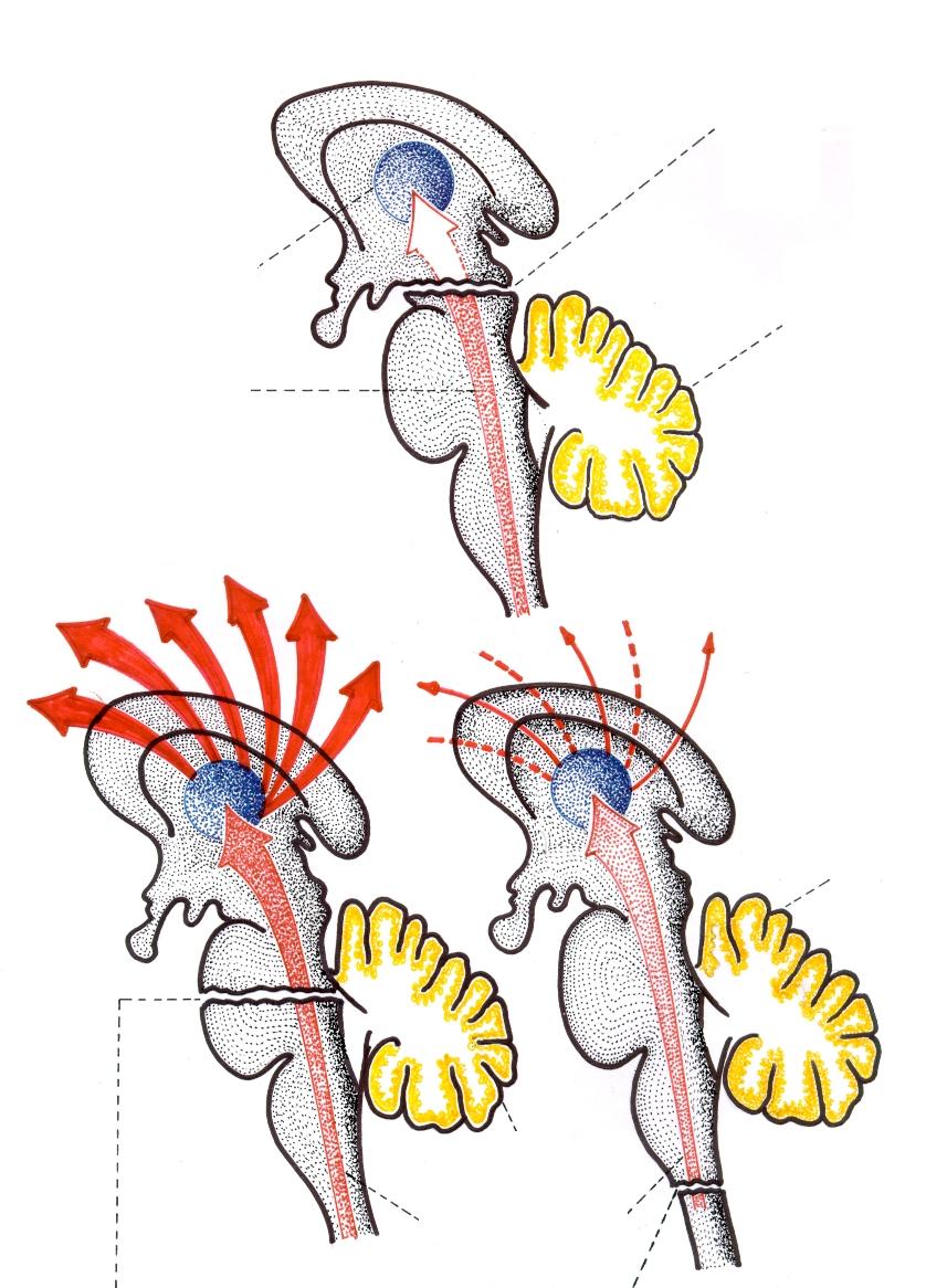 Desenhos esquemáticos das experiências de BREMER, em gatos, sobre a Formação Reticular. Córtex cerebral Primeira secção: Intercolicular E.C.G.: Sono contínuo ( cérebro isolado ).