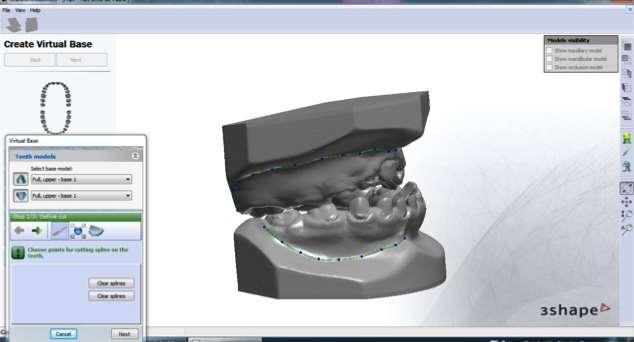 4 Material e Métodos 71 O processo de escaneamento exige que cada modelo de gesso original seja posto sobre a mesa do aparelho de scanner, o qual, com um feixe a laser, realiza uma varredura sobre a