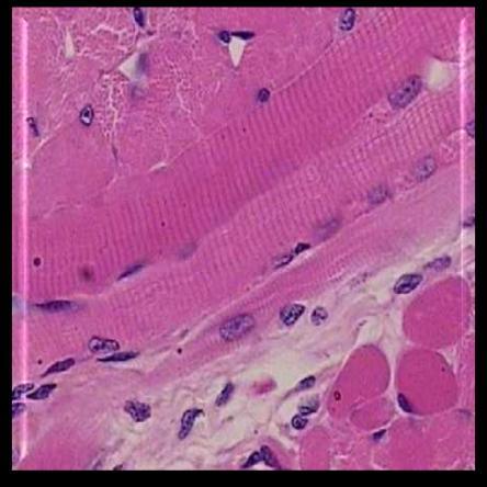 TECIDO MUSCULAR ESTRIADO ESQUELÉTICO Maior parte da musculatura dos vertebrados; Preso aos ossos (esquelética); Fibras em estrias