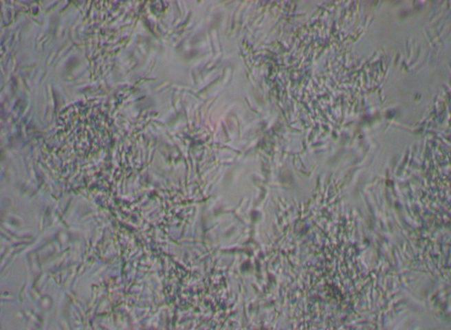 5.11 Concentração de glicerol e de células em função do tempo de