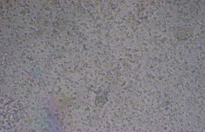 Bacillus thuringiensis, empregando o resíduo G4-Hex-dest.