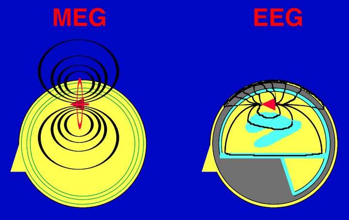 Distorção do EEG por
