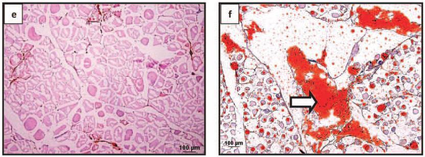 , (2015) Figura 13 Fotomicrografia do músculo Pectoralis major de frango de corte normal (e) e com o