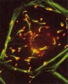 CITOESQUELETO Uma bactéria causadora de intoxicação alimentar consegue viajar de uma célula para outra utilizando uma cauda formada por actina da célula hospedeira.