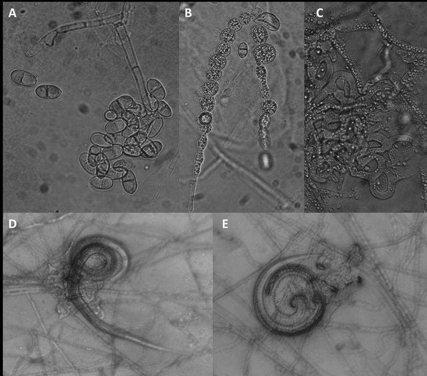 20 Figura 1: Imagens do fungo Artrobotrys cladodes var macroides feitas em microscópio de luz.